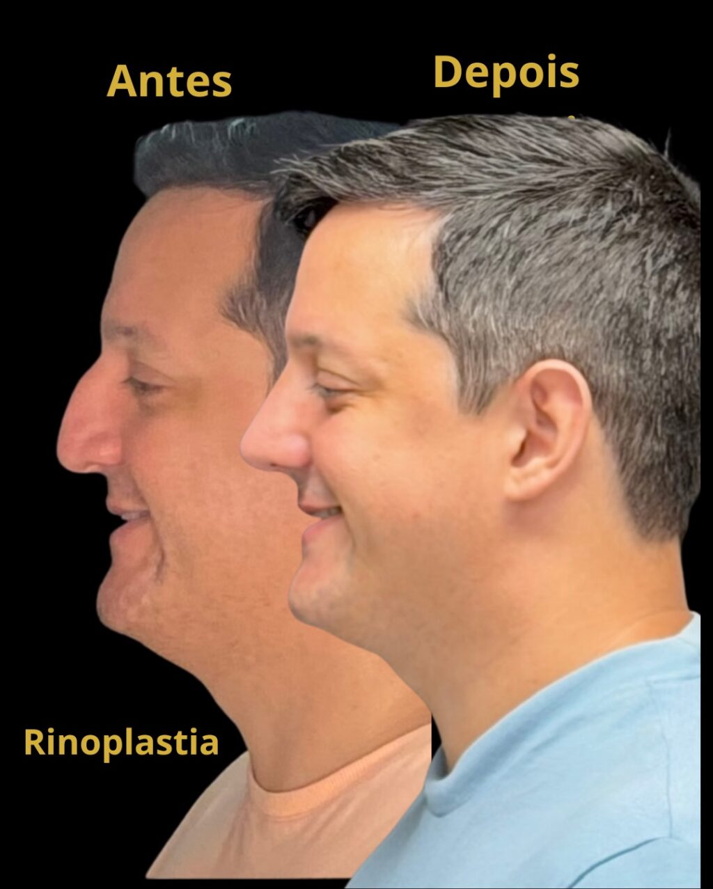 Instagram post from drglaucoalmeida. This post is in position 6.