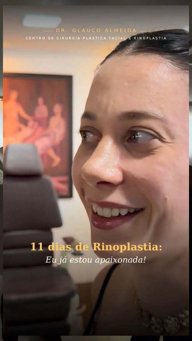 Instagram post from drglaucoalmeida. This post is in position 0.