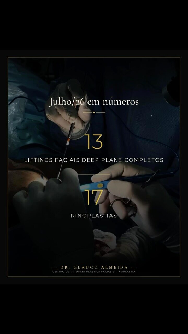 Instagram post from drglaucoalmeida. This post is in position 1.