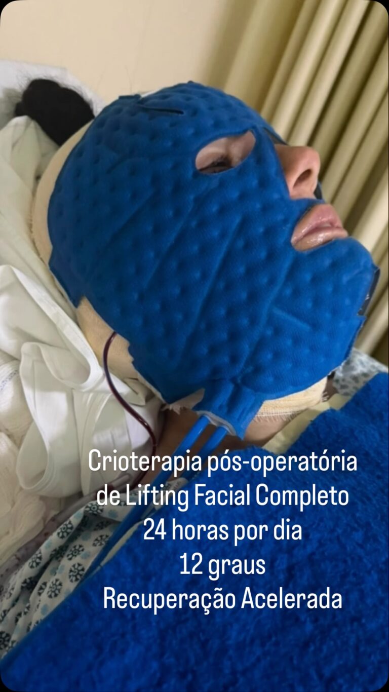 Instagram post from drglaucoalmeida. This post is in position 1.
