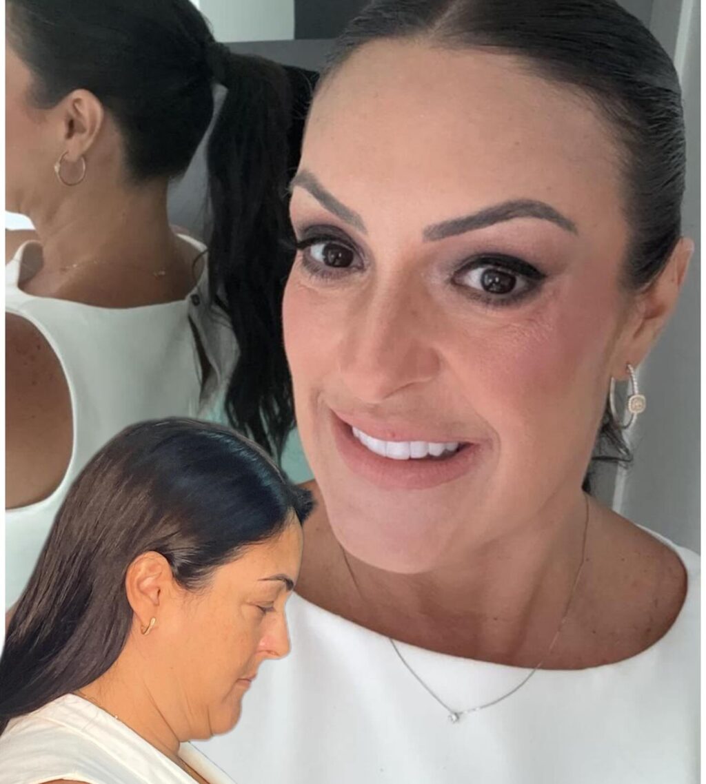 Instagram post from drglaucoalmeida. This post is in position 6.