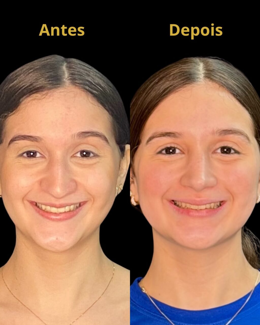 Instagram post from drglaucoalmeida. This post is in position 3.