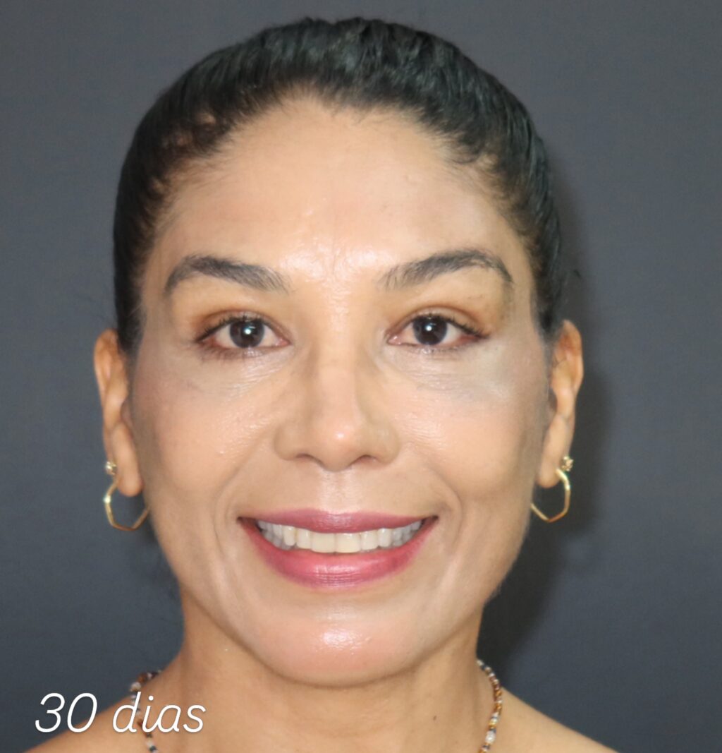 Instagram post from drglaucoalmeida. This post is in position 2.