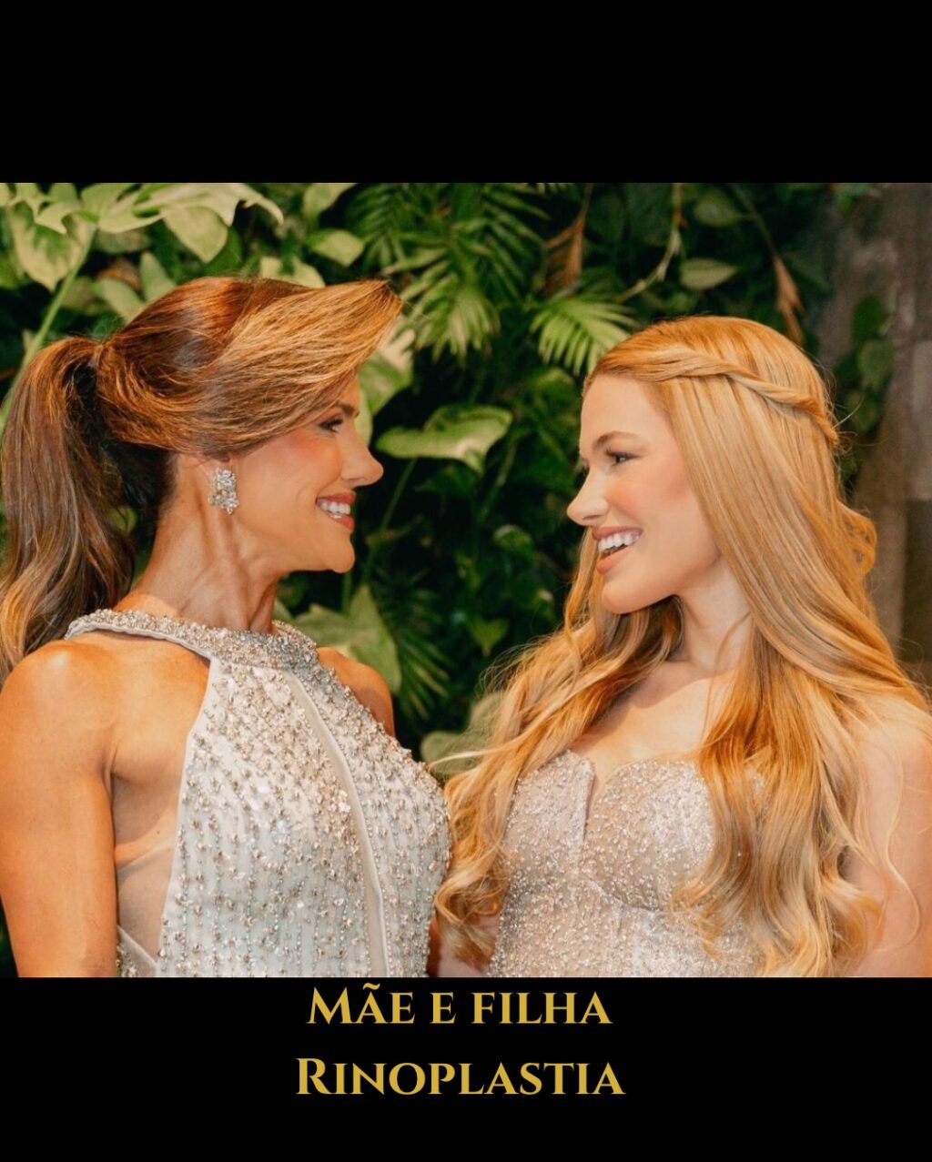 Instagram post from drglaucoalmeida. This post is in position 1.