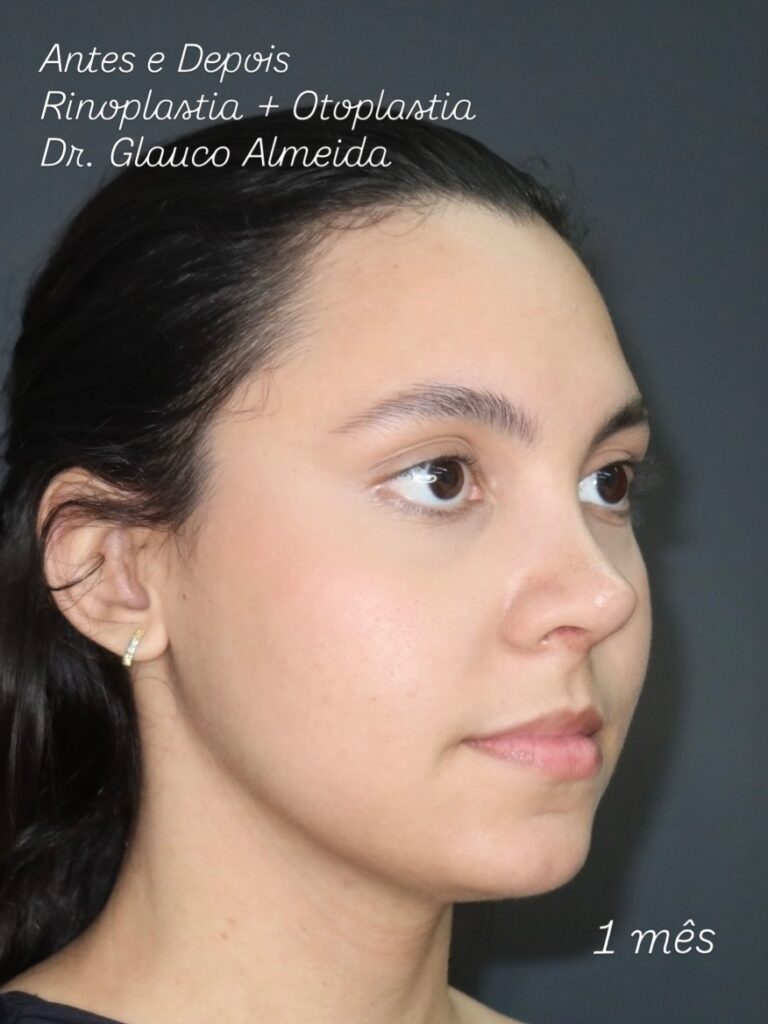 Instagram post from drglaucoalmeida. This post is in position 1.