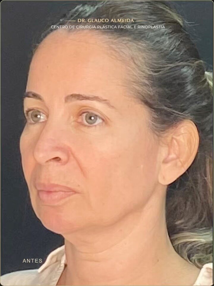 Instagram post from drglaucoalmeida. This post is in position 7.