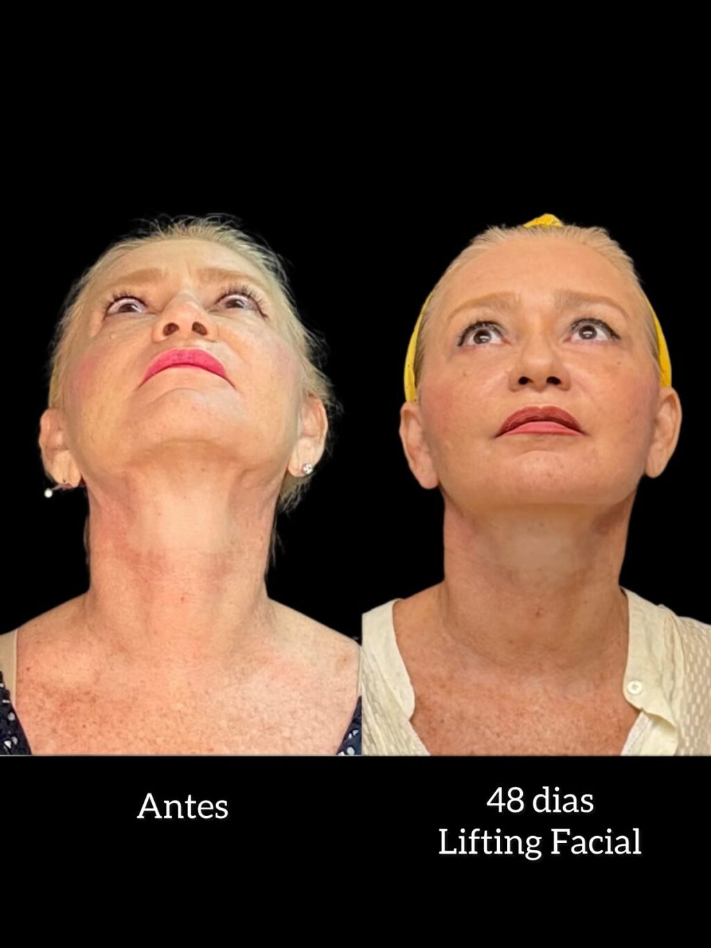 Instagram post from drglaucoalmeida. This post is in position 4.