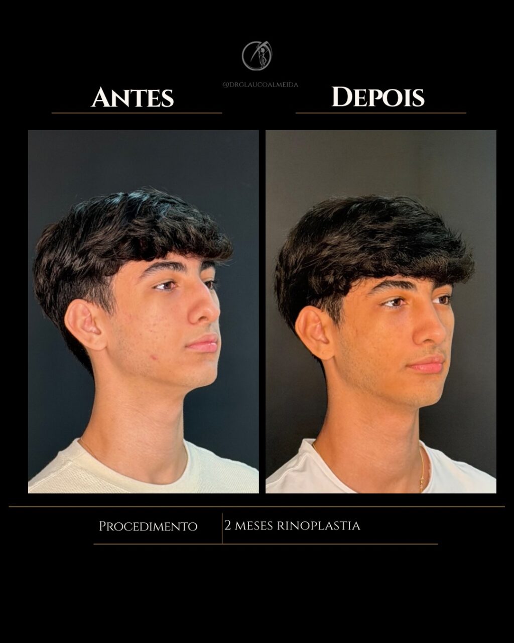 Instagram post from drglaucoalmeida. This post is in position 4.