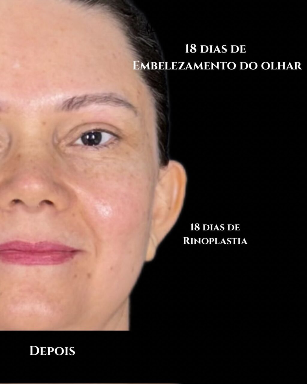 Instagram post from drglaucoalmeida. This post is in position 0.