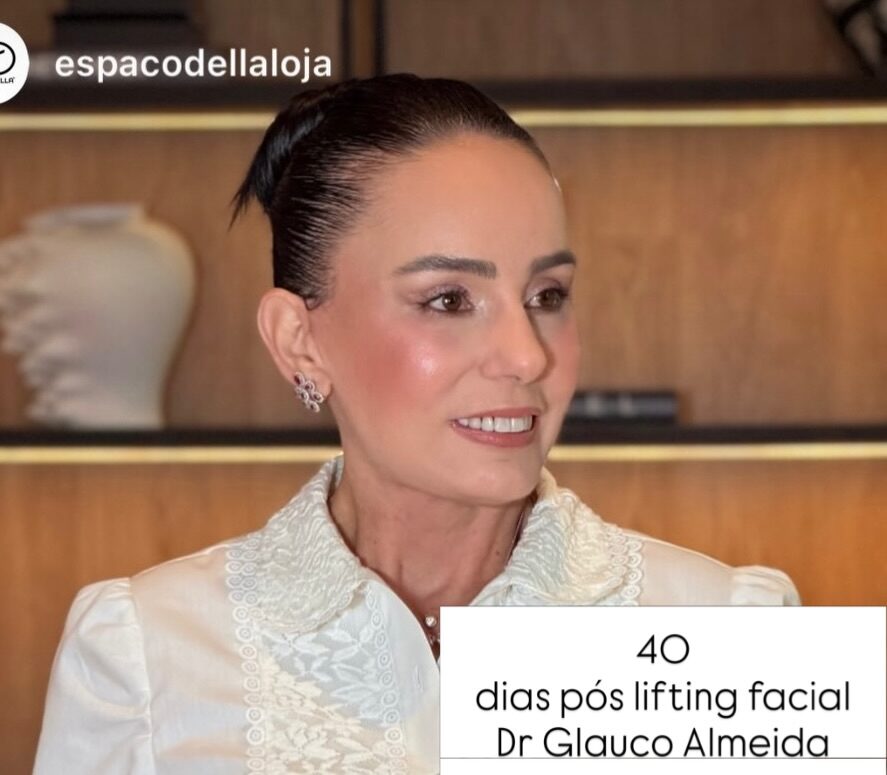 Instagram post from drglaucoalmeida. This post is in position 3.