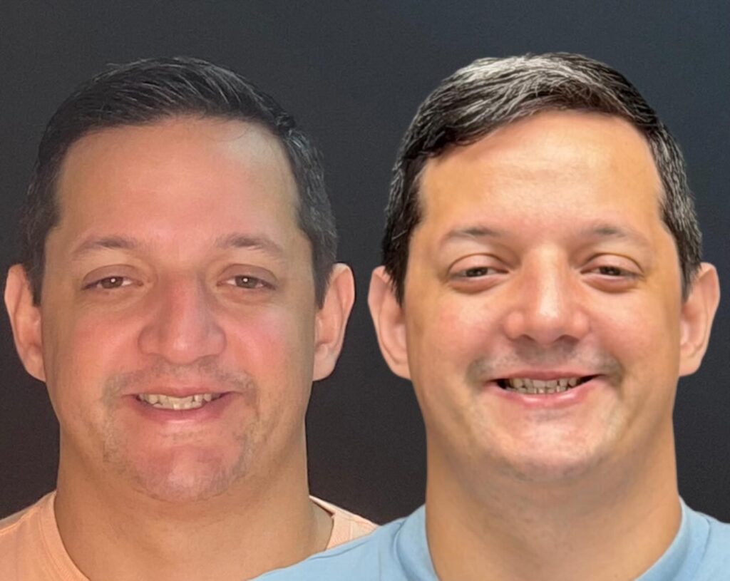 Instagram post from drglaucoalmeida. This post is in position 4.