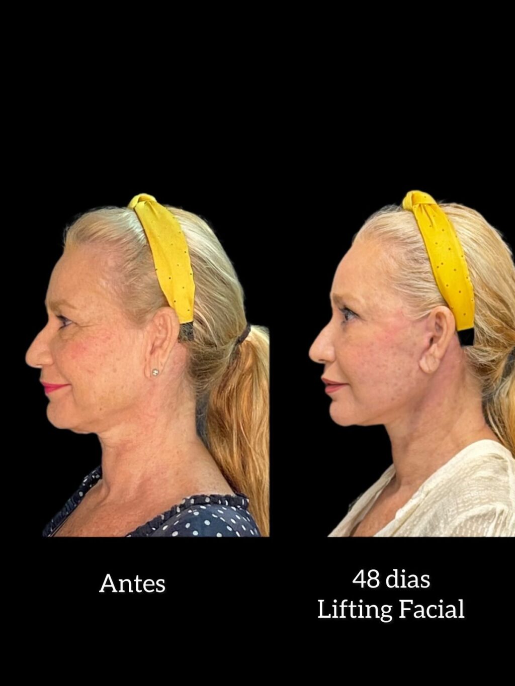 Instagram post from drglaucoalmeida. This post is in position 3.