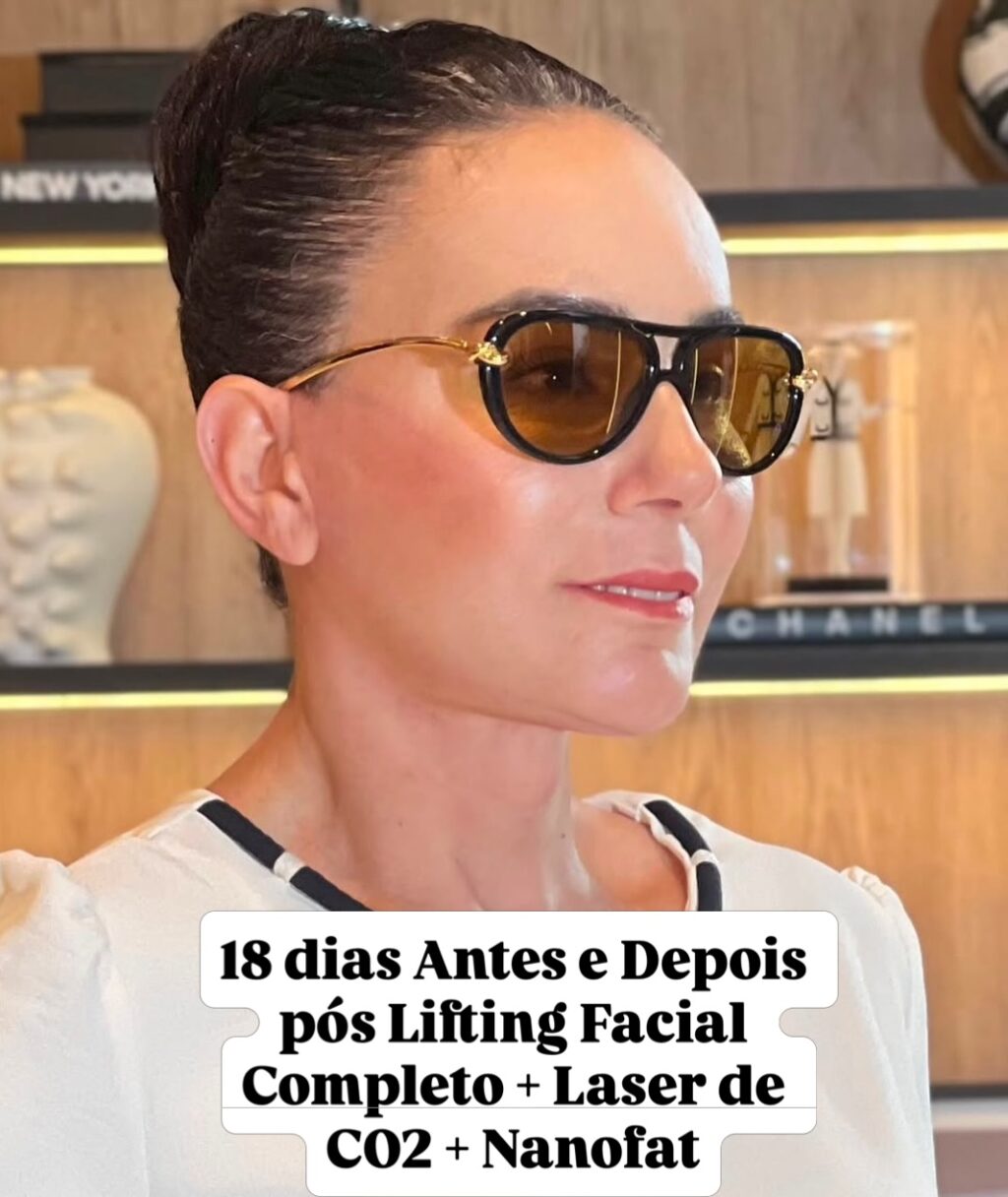 Instagram post from drglaucoalmeida. This post is in position 0.