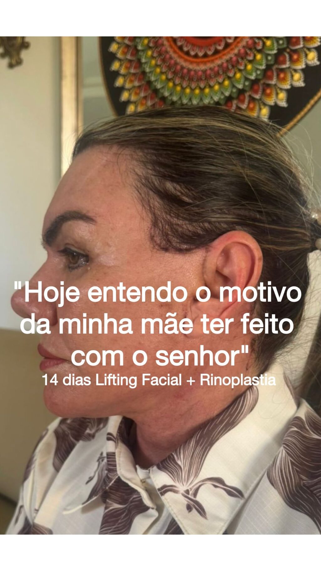 Instagram post from drglaucoalmeida. This post is in position 2.