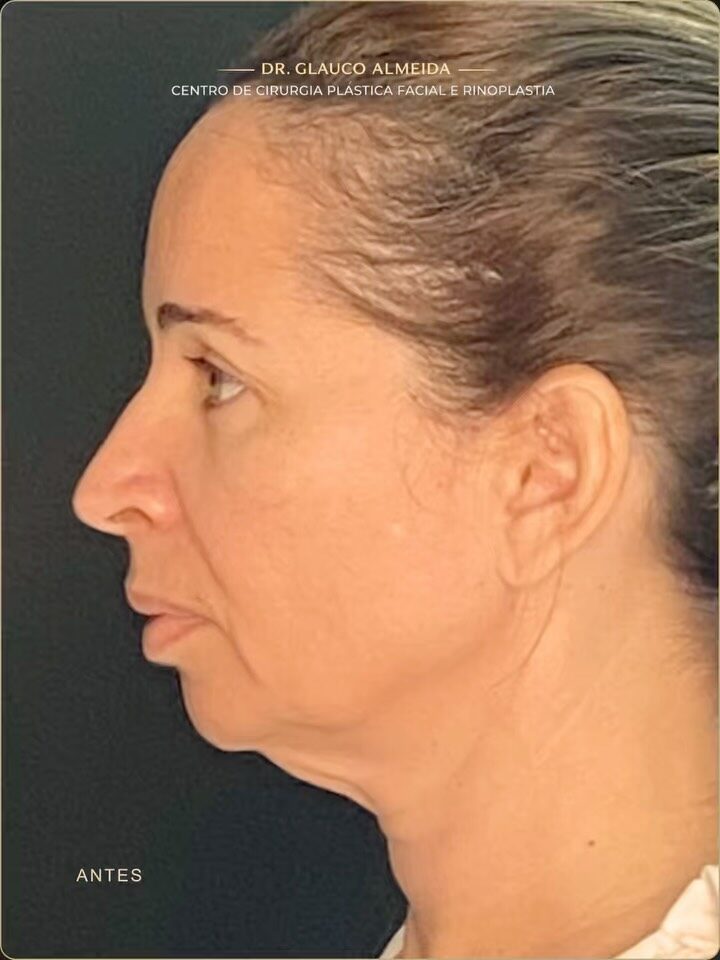 Instagram post from drglaucoalmeida. This post is in position 6.