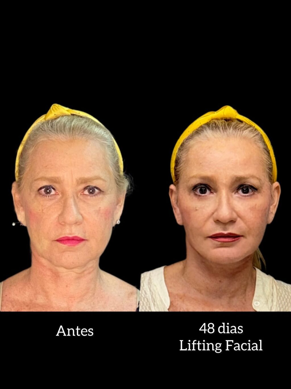 Instagram post from drglaucoalmeida. This post is in position 6.