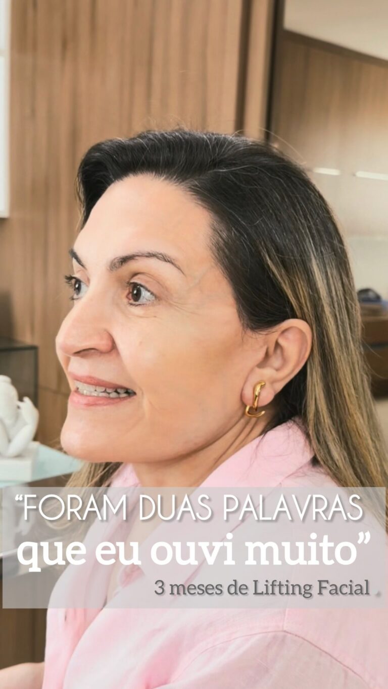 Instagram post from drglaucoalmeida. This post is in position 1.