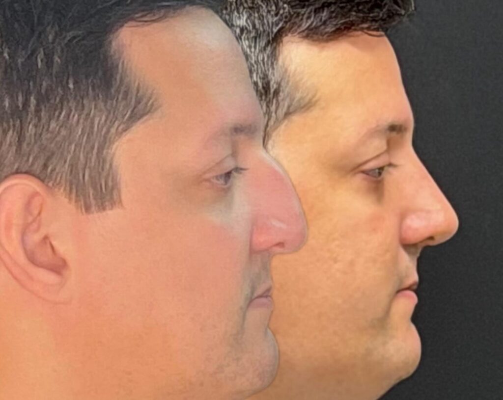 Instagram post from drglaucoalmeida. This post is in position 2.