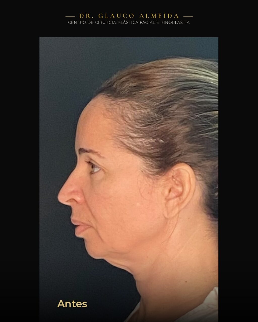 Instagram post from drglaucoalmeida. This post is in position 3.